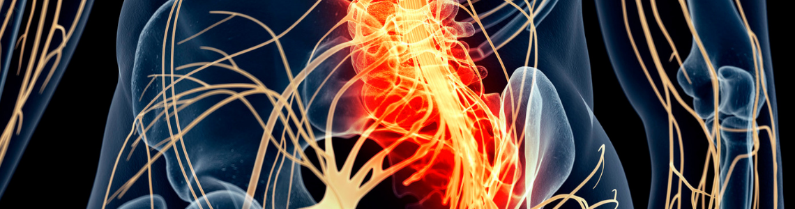 Treatment Options for Sciatica